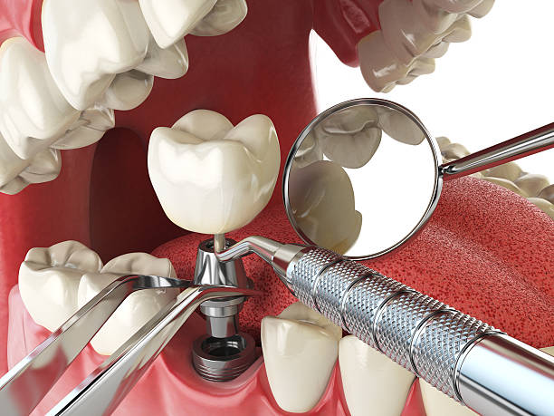 Best Emergency Treatment for Toothache in Gueydan, LA