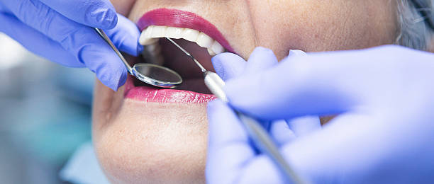 Best Walk-In Emergency Dentist in Gueydan, LA